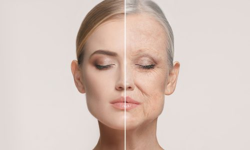 Comparison.,Portrait,Of,Beautiful,Woman,With,Problem,And,Clean,Skin, Comparison.,Portrait,Of,Beautiful,Woman,With,Problem,And,Clean,Skin,